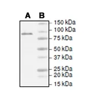 TET1 Protein (Active)