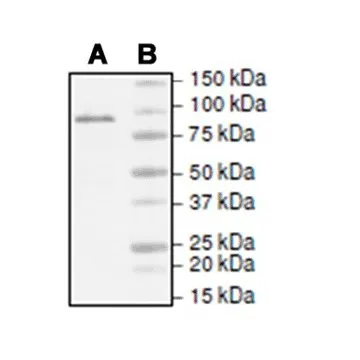 TET1 Protein (Active)