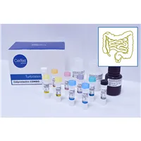 Calprotectin Turbilatex (200 testů)